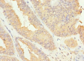 Polyclonal Rabbit anti-Human RAB17 Antibody (IHC, WB)