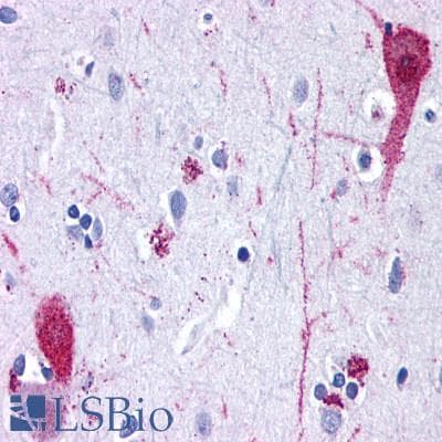 PathPlus™ GRM4 / MGLUR4 Antibody (N-Terminus)