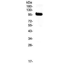 APP / Beta Amyloid Precursor Antibody