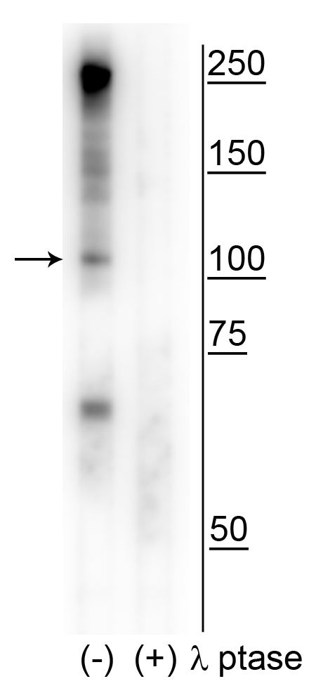 RBBP8 / CTIP Antibody (phospho-Ser327)