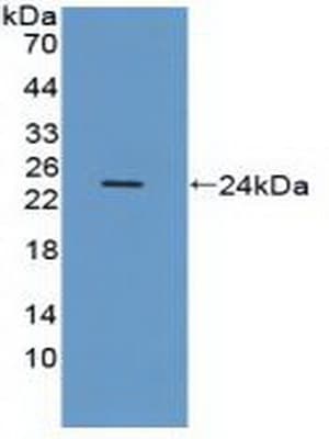 ITGAV/Integrin Alpha V/CD51 Antibody (aa560-744, APC)