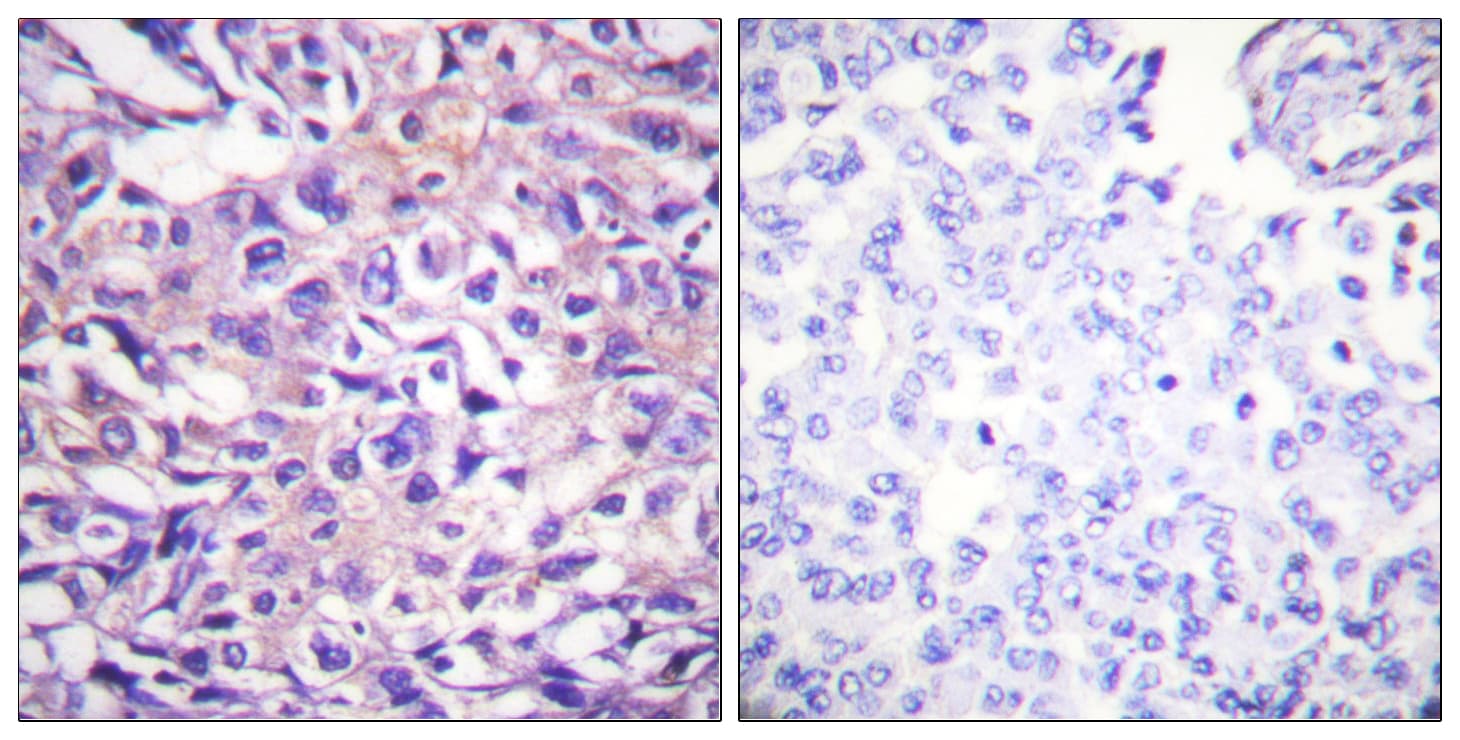 PPP1R12A / MYPT1 Antibody (phospho-Thr696)