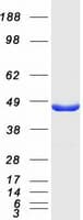 Human KDM8 / JMJD5 / FLJ13798 Protein (Recombinant Myc-DDK (Flag))