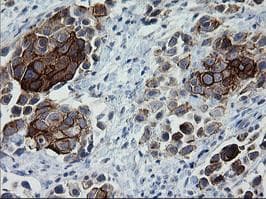 ERBB2 / HER2 Antibody (aa676-1255, clone OTI5C3, Carrier-free)