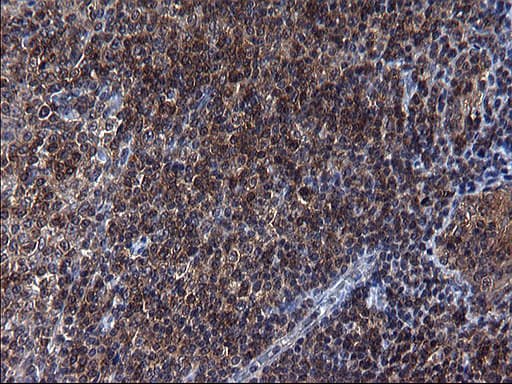 Monoclonal Mouse anti-Human SCRN1 / Secernin 1 Antibody (clone OTI1F2, IHC, WB)