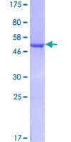 Human GSTA3 Protein (Recombinant GST)
