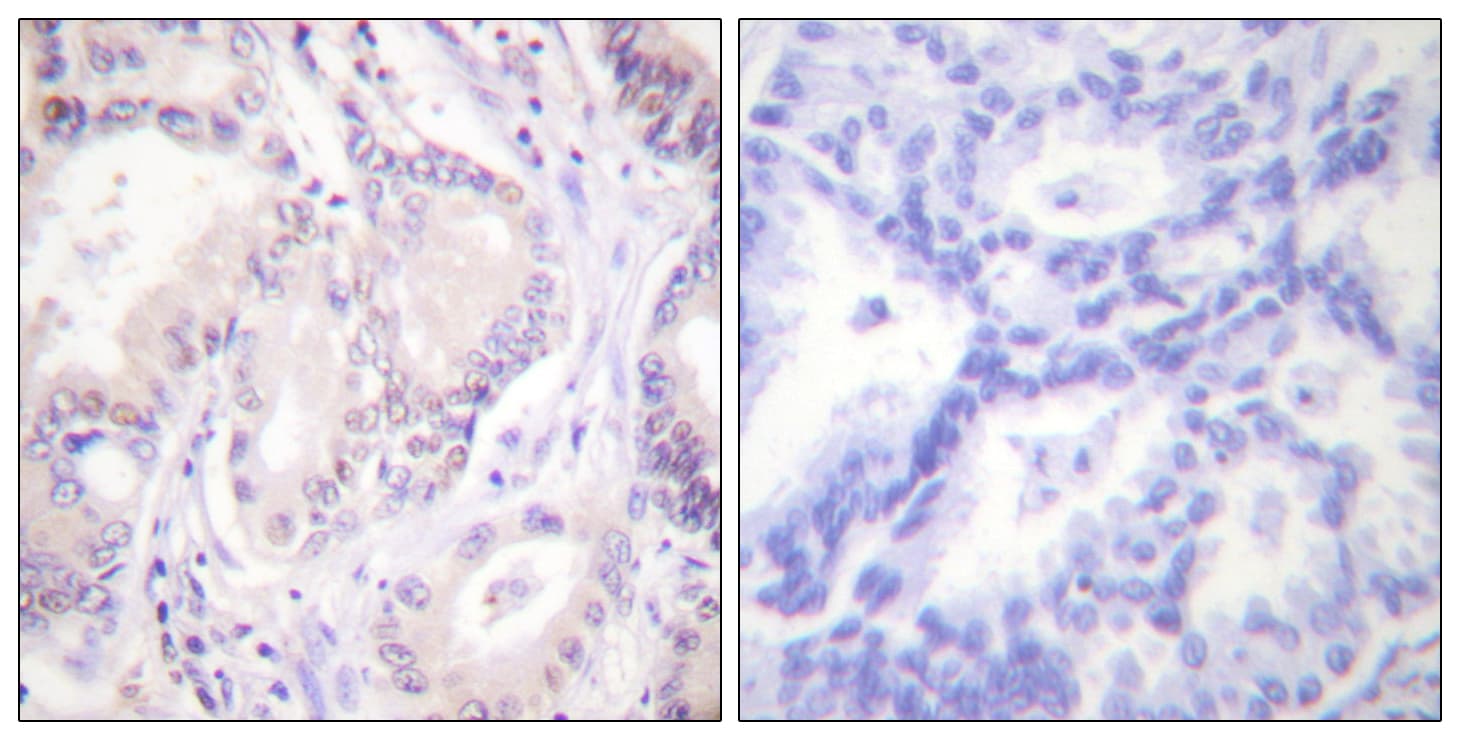 CDC6 Antibody (phospho-Ser54)
