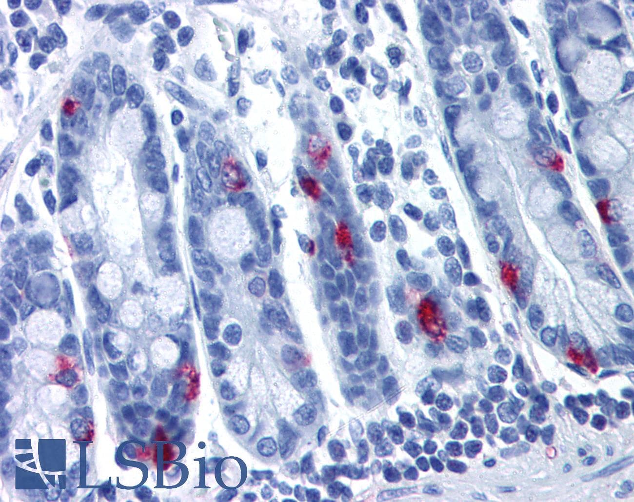 PathPlus™ Polyclonal Rabbit anti-Human MLNR/GPR38/Motilin Receptor Antibody (Cytoplasmic Domain, IHC)