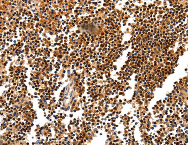 HDAC1 Antibody