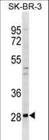 ZNF688 Antibody (aa83-110)