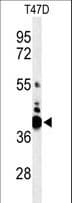 VTCN1 / B7-H4 Antibody (aa72-100)