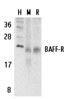 BAFF Receptor / CD268 Antibody