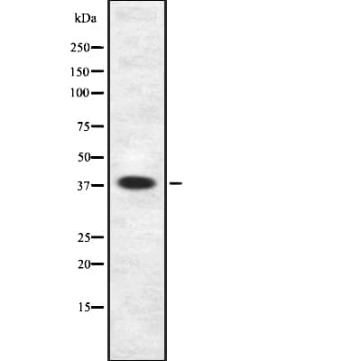 SSTR5 Antibody