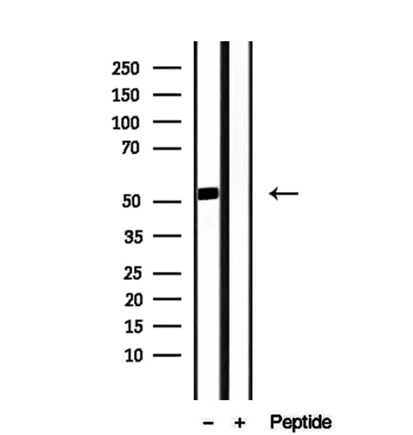 DMAP1 Antibody