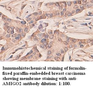 IHC-plus™ AMIGO2 Antibody (C-Terminus)