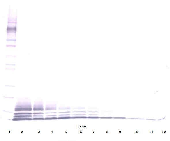 CCL5 / RANTES Antibody (Biotin)