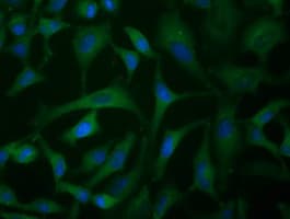 IGF2BP2 Antibody (clone OTI2H7)