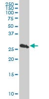 Monoclonal Mouse anti-Human PSMB10 Antibody (clone 3F8, IF, WB)