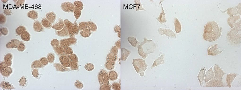 p16INK4a / CDKN2A Antibody (clone OTI7A6)