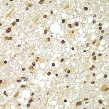Polyclonal Rabbit anti-Human ZNF20 Antibody (IHC, WB)