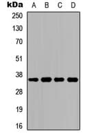 Polyclonal Rabbit anti-Human ACKR1 / DARC Antibody (N-Terminus, IF, WB)