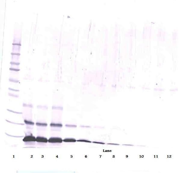 PTHLH / PTHRP Antibody