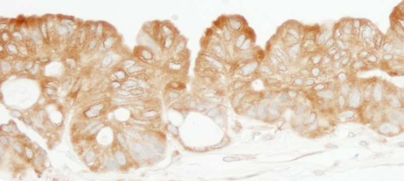 KARS Antibody (aa550-C-term)