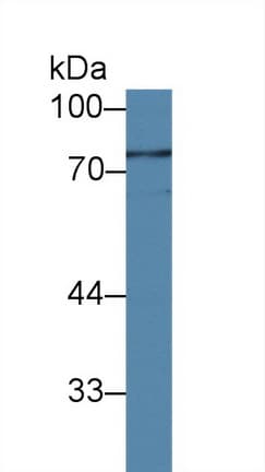 IL12RB1 / CD212 Antibody (aa37-234)
