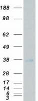 Human NRBP2 Protein (Recombinant Myc-DDK (Flag))