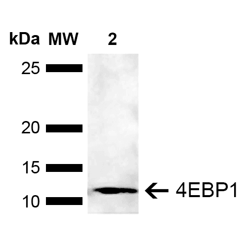 EIF4EBP1 / 4EBP1 Antibody (PerCP)