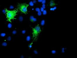 SMS / Spermine Synthase Antibody (clone OTI3C9)