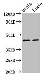 Polyclonal Rabbit anti-Human MAPK3 / ERK1 Antibody (IHC, WB)