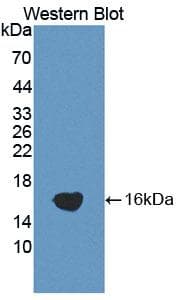 ADAMTS1 Antibody (aa854-967)