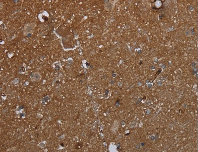 Polyclonal Rabbit anti-Human GALT Antibody (IHC, WB)