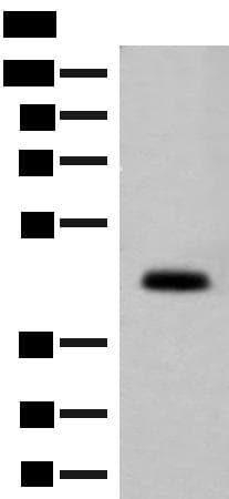 Polyclonal Rabbit anti-Human GPA33 / A33 Antibody (WB)