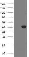 MGLL / Monoacylglycerol Lipase Antibody (clone OTI2G8)