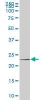 NOP16 Antibody (clone 1G4)