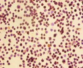 CDK4 Antibody