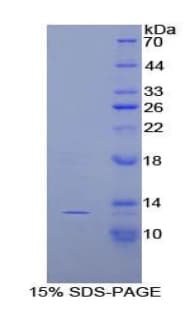 Rat SLIT3 Protein (Recombinant His-S)