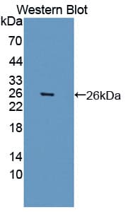 ARNTL / BMAL1 Antibody (aa1-169, FITC)