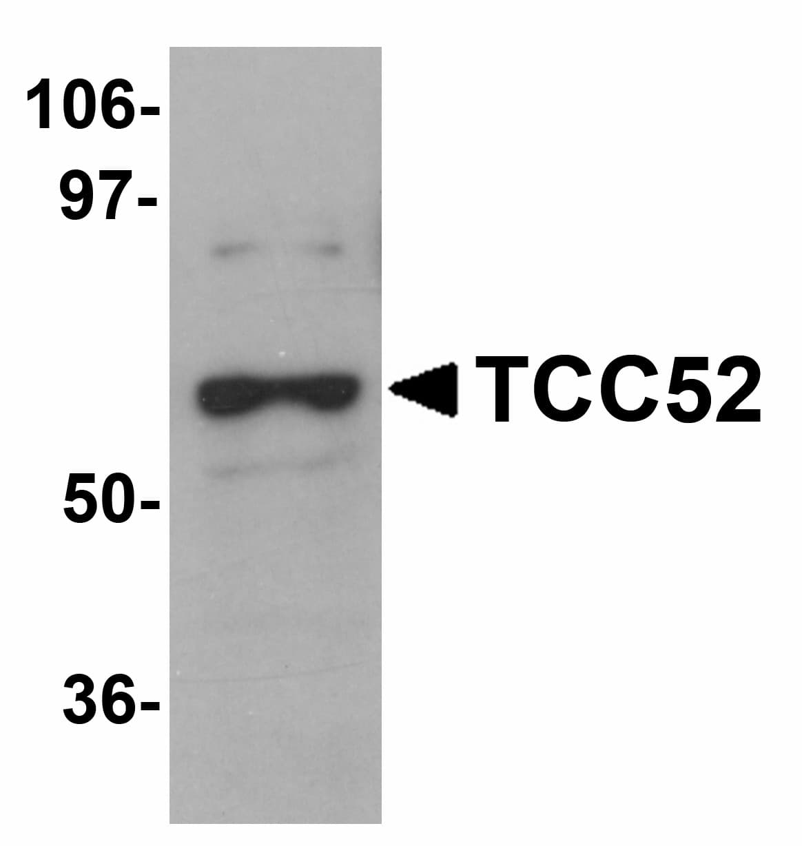 Polyclonal Chicken anti-Human DCAF12 / WDR40A Antibody (WB)