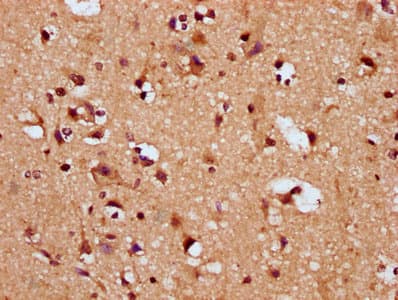 Polyclonal Rabbit anti-Human SNRPE Antibody (IHC, IF, WB)