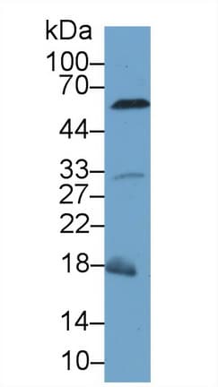 CASP8 / Caspase 8 Antibody (aa1-218)