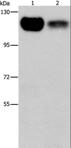 Polyclonal Rabbit anti-Human PRKD1 / PKC Mu Antibody (IHC, WB)