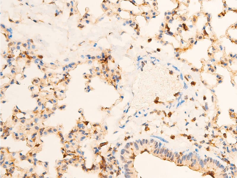 Polyclonal Rabbit anti-Human NTRK1 / TrkA Antibody (phospho-Tyr680,phospho-Tyr681, IHC, WB)