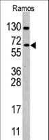 IHC-plus™ Polyclonal Rabbit anti-Human CDC25B Antibody (aa331-360, IHC, WB)