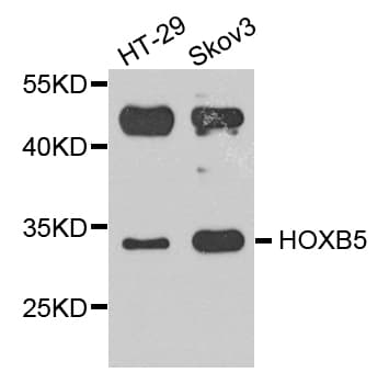 HOXB5 Antibody