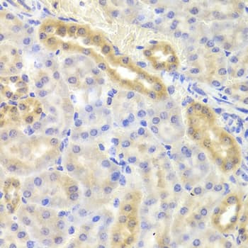 DIAPH1 Antibody