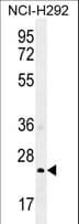 GSTA3 Antibody (aa1-30)