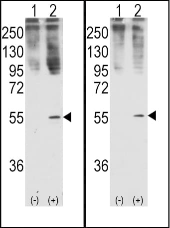 Polyclonal Rabbit anti-Human GDF11 / GDF-11 Antibody (aa32-61, IHC, WB)